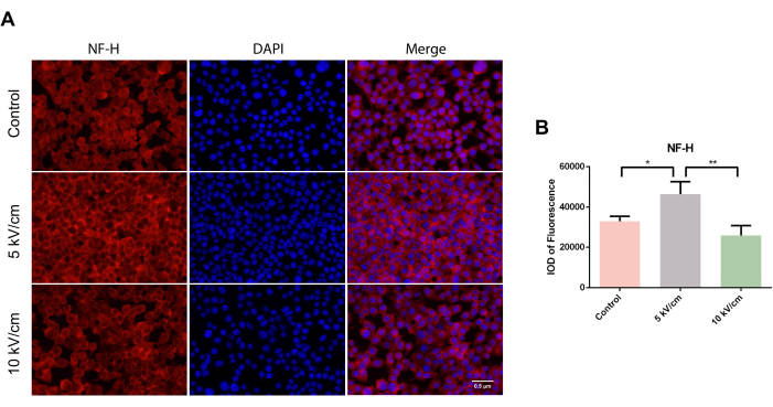 figure-results-3 Immunofluorescence microscopy, NF-H protein expression, electric field effect, fluorescence intensity.