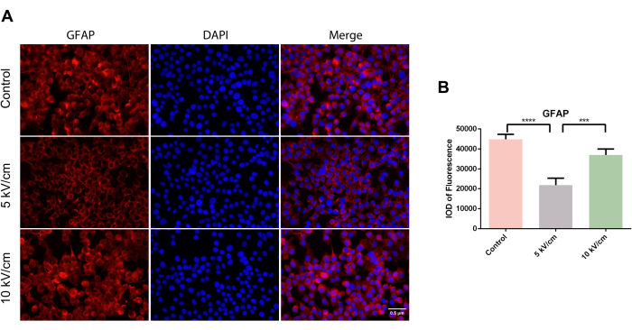 figure-results-4 GFAP immunofluorescence assay results, microscopy images, and bar chart show fluorescence intensity.