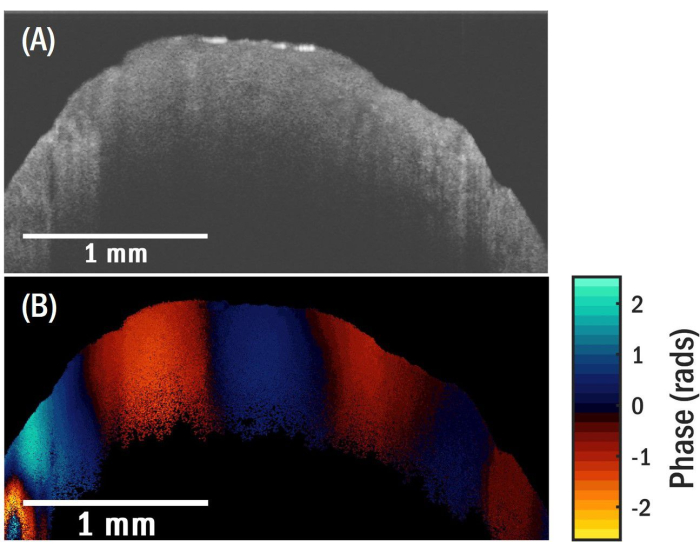 Optical coherence tomography; A) grayscale, B) phase map diagram; phase analysis, 1 mm scale.