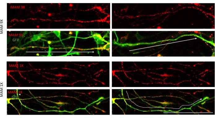 figure-results-2 Neuronal pathways, confocal microscopy images, 9x and 1x magnification, fluorescence analysis.