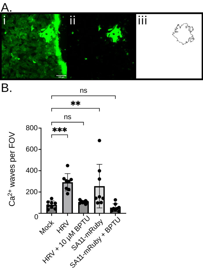 Live Calcium Imaging of Virus-Infected Human Intestinal Organoid
