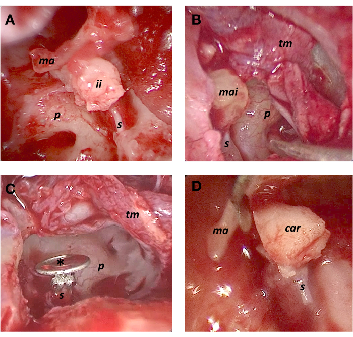 Surgical anatomy; labeled tissue structures; diagram of procedures and tissue identification.
