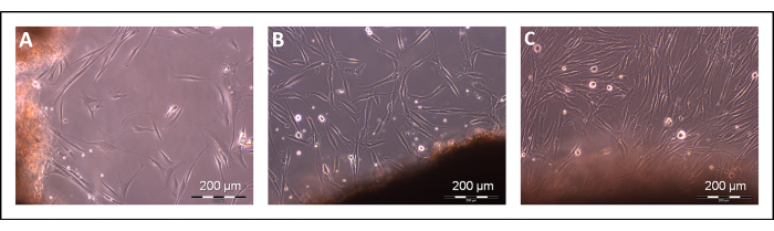 Cell culture growth phases under microscope; 200 μm scale; microscopy analysis; experiment results.