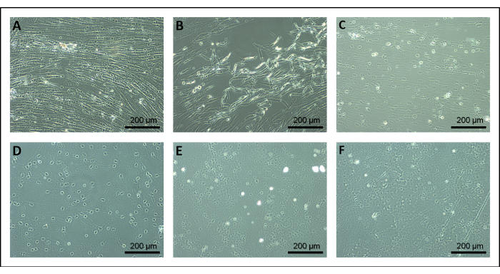 Cell morphology changes, microscope images, culture study, 200μm scale, experimental analysis.