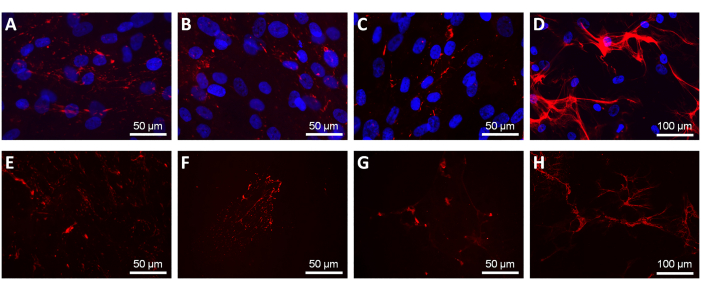 Fluorescence microscopy images of cell structures showing actin filaments; red and blue staining.
