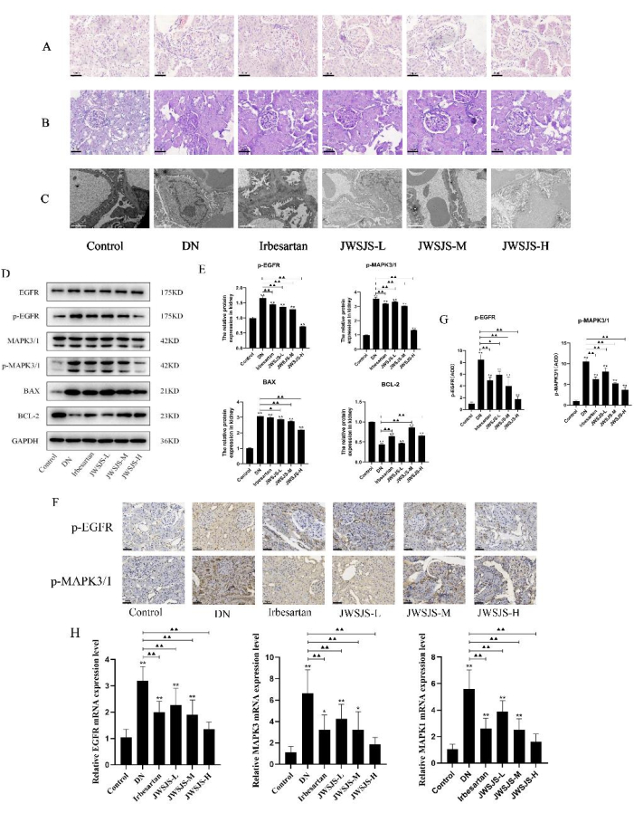 Histological analysis, Western blot, and bar charts in diabetic nephropathy treatment research.