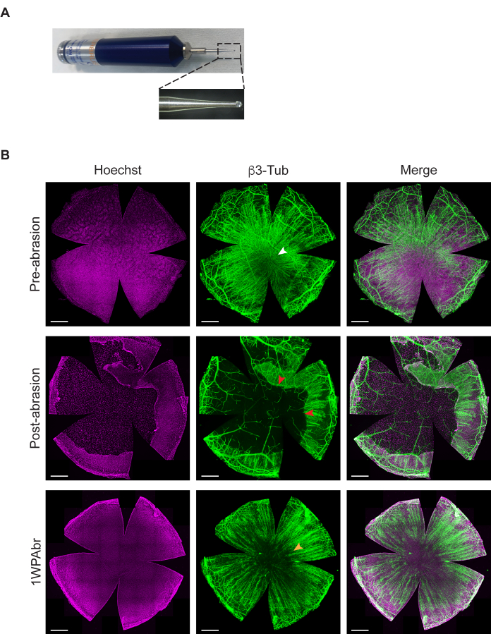 Abrasion tool setup and fluorescence microscopy, pre-post abrasion nerve tissue, cell staining results.
