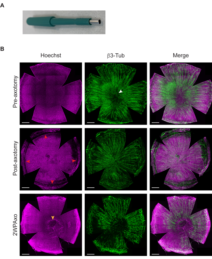 Axotomy experiment diagram, Hoechst and β3-Tub staining, pre and post-axotomy cell analysis.