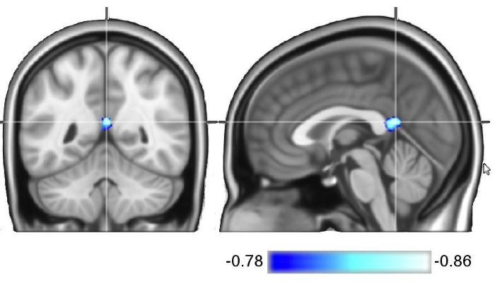 figure-results-1 Brain MRI scan highlighting neural activation regions; diagram with activation intensity scale.