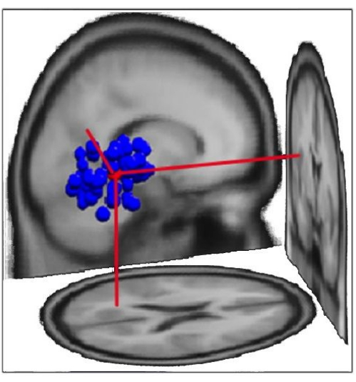 figure-results-2 Brain mapping diagram with 3D coordinates, fMRI data analysis, neurological study.