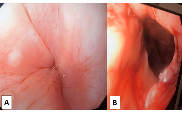 figure-results-1 Endoscopic images of airway structure analysis, highlighting tissue composition and anatomy.