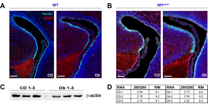 Neuroscience study; brain tissue immunofluorescence analysis in WT vs Nf1mut mice; β-actin blot.