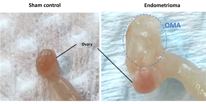 Ovary comparison in sham control vs. endometrioma; anatomical study image highlighting differences.