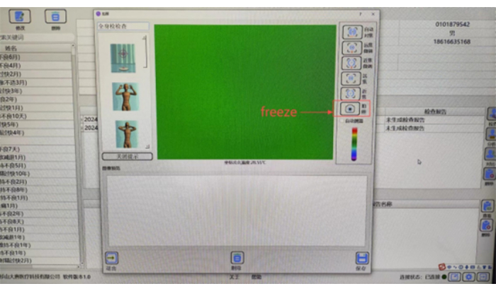 Medical imaging software interface displaying ultrasound freeze feature, includes patient data panel.
