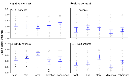 figure-results-2 Motion acuity thresholds for RP and STGD patients; graph comparing negative, positive contrast setups.