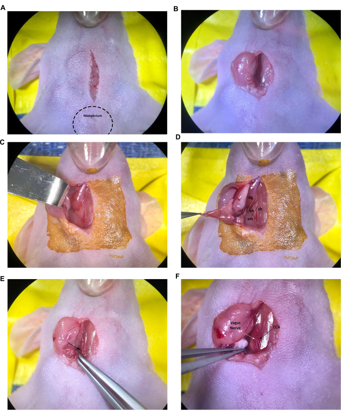 Surgical dissection sequence, vagus nerve exposure, labeled diagram, anatomical study.