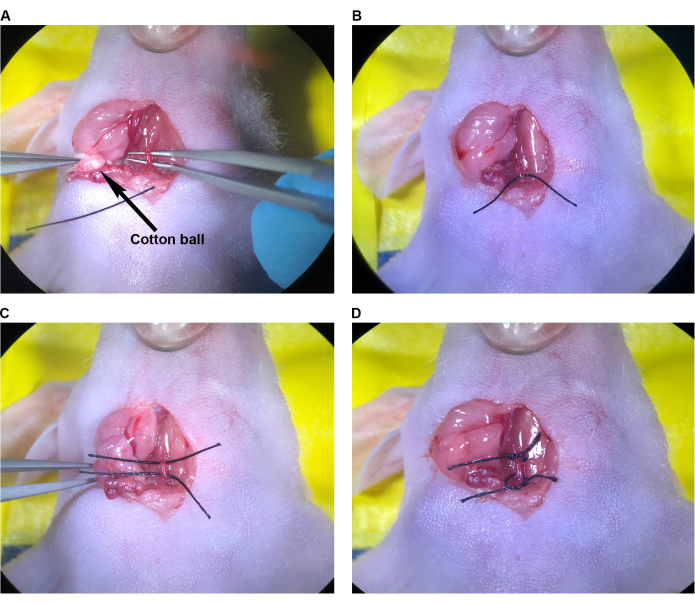 Surgical wound closure process with cotton ball, suture technique, medical experiment series.