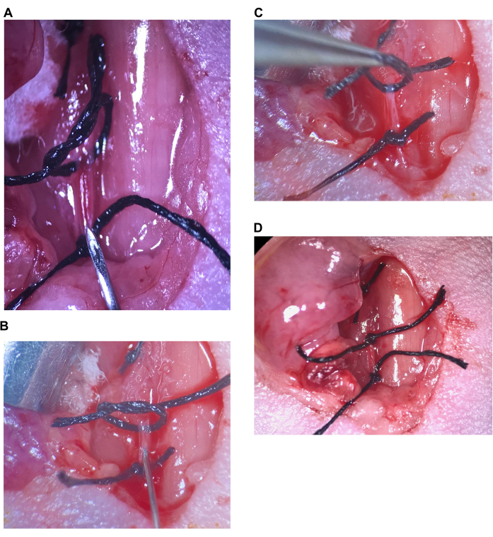 Surgical knot tying techniques, close-up, experiment setup, vascular suturing, precision in surgery.