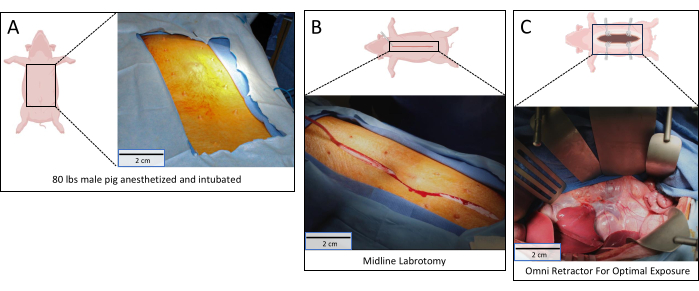 figure-results-1 Surgical procedure on anesthetized pig, featuring midline laparotomy and Omni retractor.