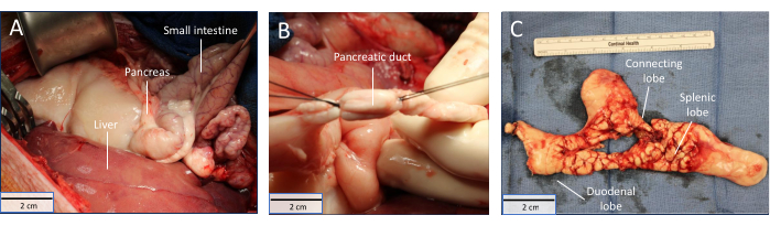 figure-results-5 Pancreatic dissection process, labeled anatomy, digestive system exploration, surgical experimentation.