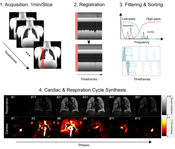 Cardiac MRI workflow diagram; acquisition, registration, filtering, synthesis of cardiac/respiration cycles.