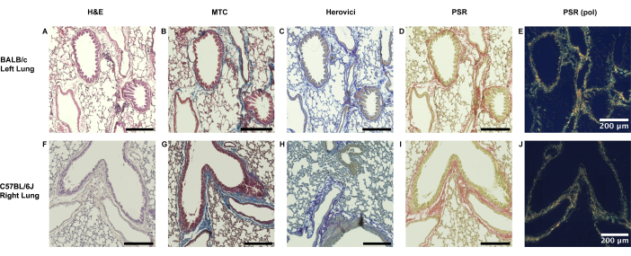 Lung tissue histochemical staining, includes H&E, MTC, Herovici, PSR microscopy images, 200 μm scale.