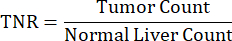 Static equilibrium, ratio TNR=Tumor Count/Normal Liver Count formula, research analysis.