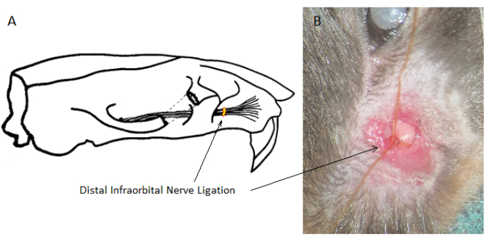 Distal infraorbital nerve ligation; diagram and image illustrating surgical procedure on a rodent model.