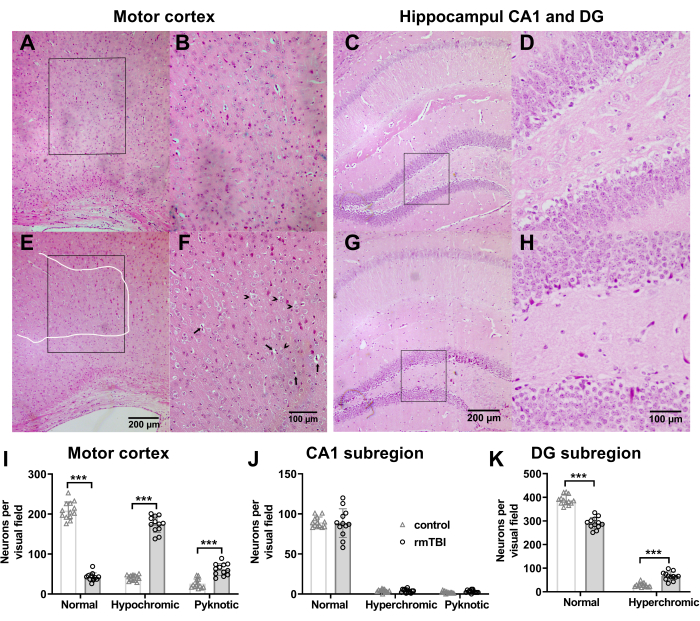 figure-results-6 Histology analysis of motor cortex and hippocampus; stained tissue sections and neuron density graphs.