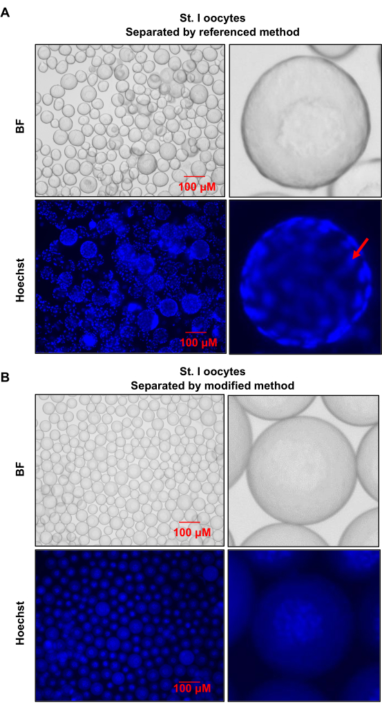 figure-results-3 St. I oocytes brightfield and Hoechst analysis; cell separation methods comparison; microscopy images.