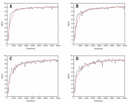 Convergence graphs of DICE vs. iterations for four models, showing performance trends over time.