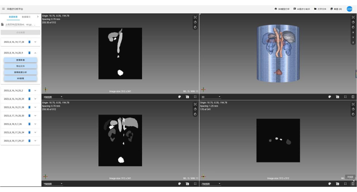 Medical imaging analysis; 3D organ model, CT scan slices, diagnostic visualization, segmentation.