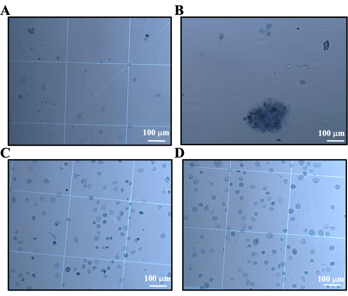Microscopy image showing cell proliferation at different stages; grid lines, 100 μm scale.