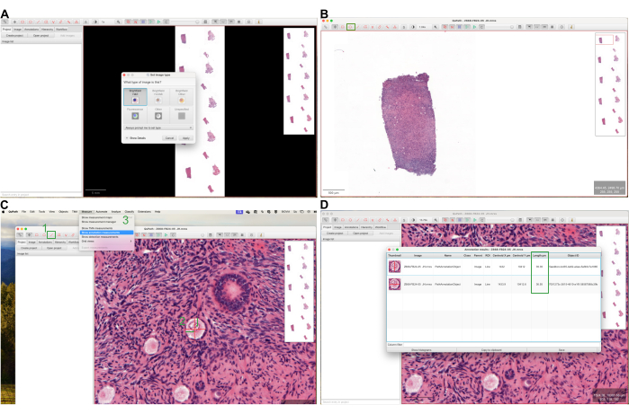 Histology image analysis process; A-D panels; microscopy setup; digital pathology workflow.