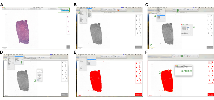 Image analysis workflow chart; microscopy image segmentation; highlight regions of interest.