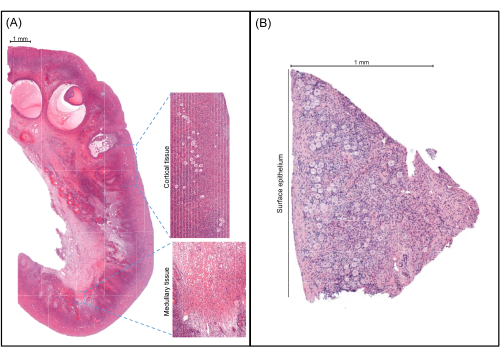 Histology slide, kidney tissue sections, cortex and medulla analysis, microscope image.