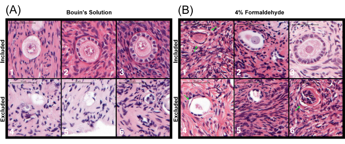 Histology comparison, Bouin's vs Formaldehyde; staining results of tissue samples in microscopic images.