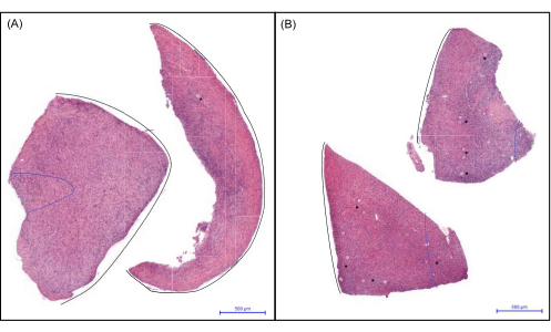 Histology sample comparison, diagram showing tissue slices in microscopy for cellular analysis.