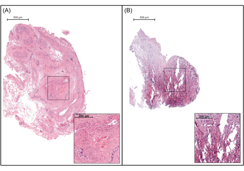 Histology comparison; microscope images of tissue samples with magnified insets, 500μm and 200μm scales.