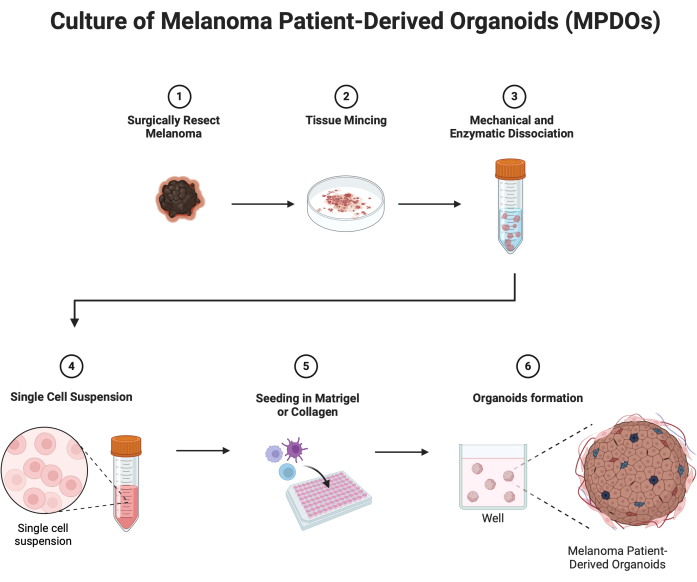 figure-results-1 Culture process of melanoma organoids; diagram of tissue mincing, dissociation, and formation steps.