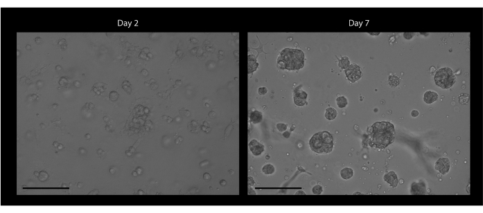 figure-results-2 Cell growth over time, microscope image, Day 2 vs Day 7, scientific research, cell culture analysis.