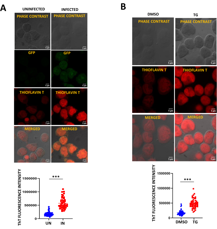 figure-results-4 Fluorescence microscopy and phase contrast images; GFP, Thioflavin T staining; intensity graph.