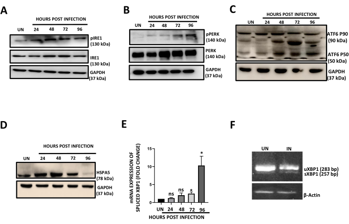 figure-results-5 Protein expression analysis, Western blot and RT-PCR results showing infection response over time.