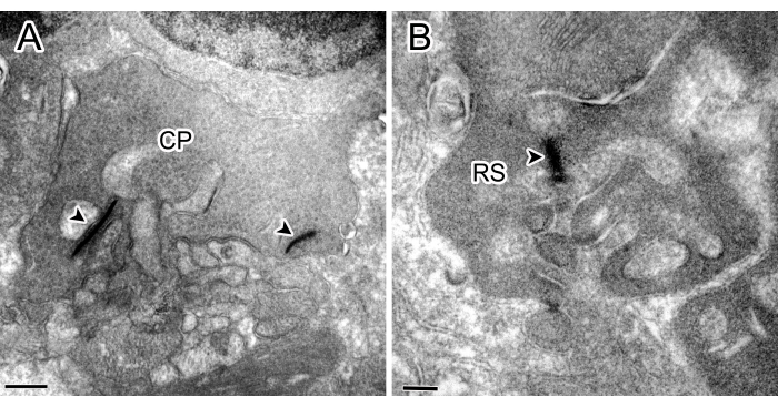 Ultrastructural analysis, electron microscopy images (A, B); cellular structures marked CP, RS.