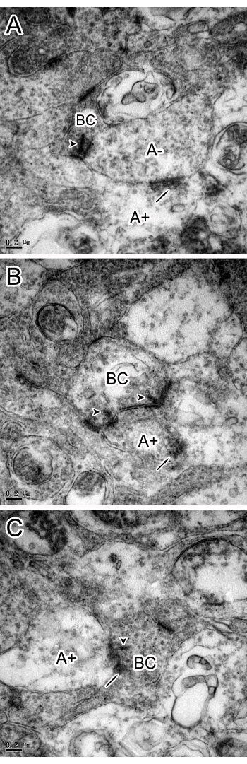 Electron microscopy of cellular structure, labels indicate regions; image series for cell study analysis.