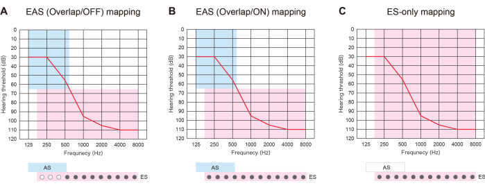 EAS and ES mapping chart; hearing threshold vs. frequency, audiometry analysis results.
