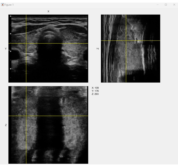 Obrazowanie ultrasonograficzne pokazujące płaszczyzny X, Y, Z w medycznym układzie diagnostycznym, analiza przekrojowa.