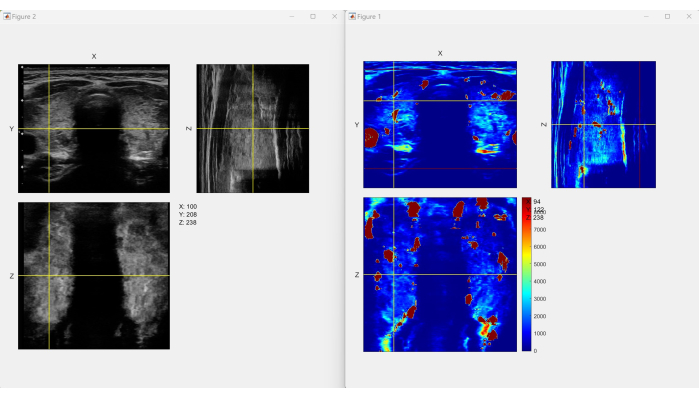 Porównanie ultrasonograficzne i termowizyjne, analiza diagnostyczna, wykres rozkładu temperatury.