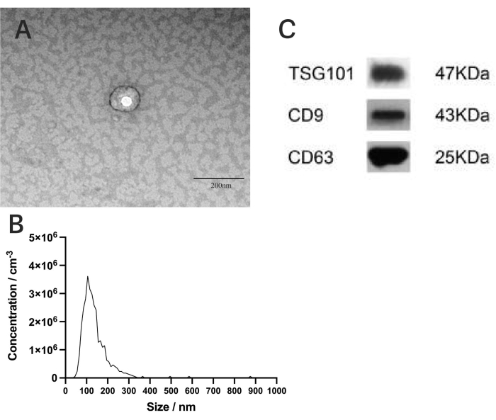 Electron microscopy, protein expression, size distribution; nanoparticle analysis, Western blot profile.