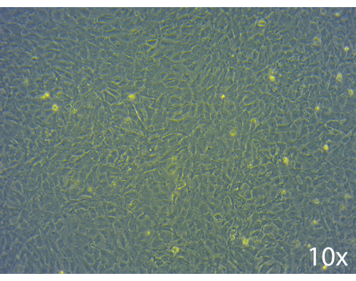 Cellular morphology, 10x microscope image, cell culture analysis, biological research, microscopy.